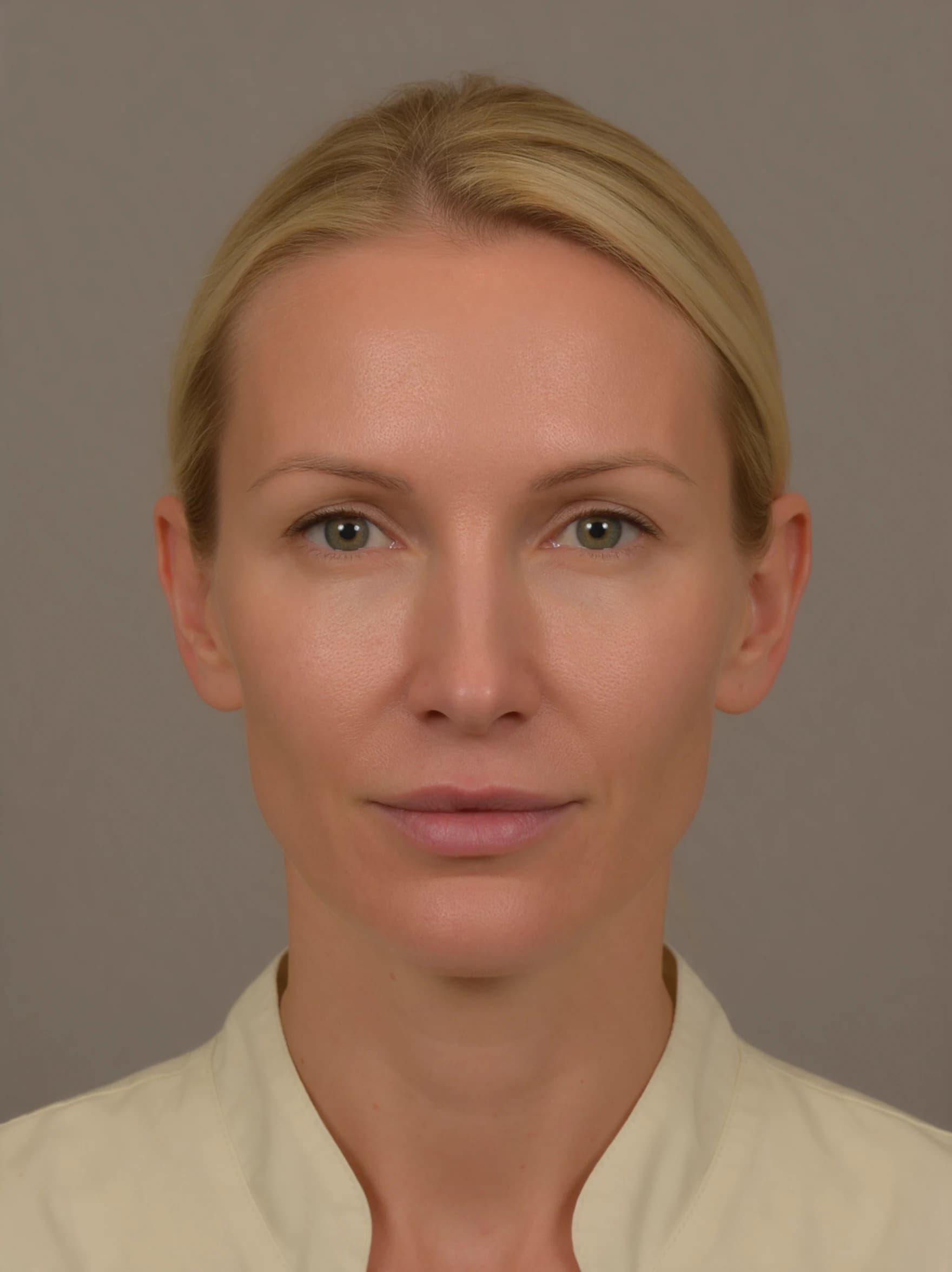 Dermal Fillers — AI simulated consultation view before