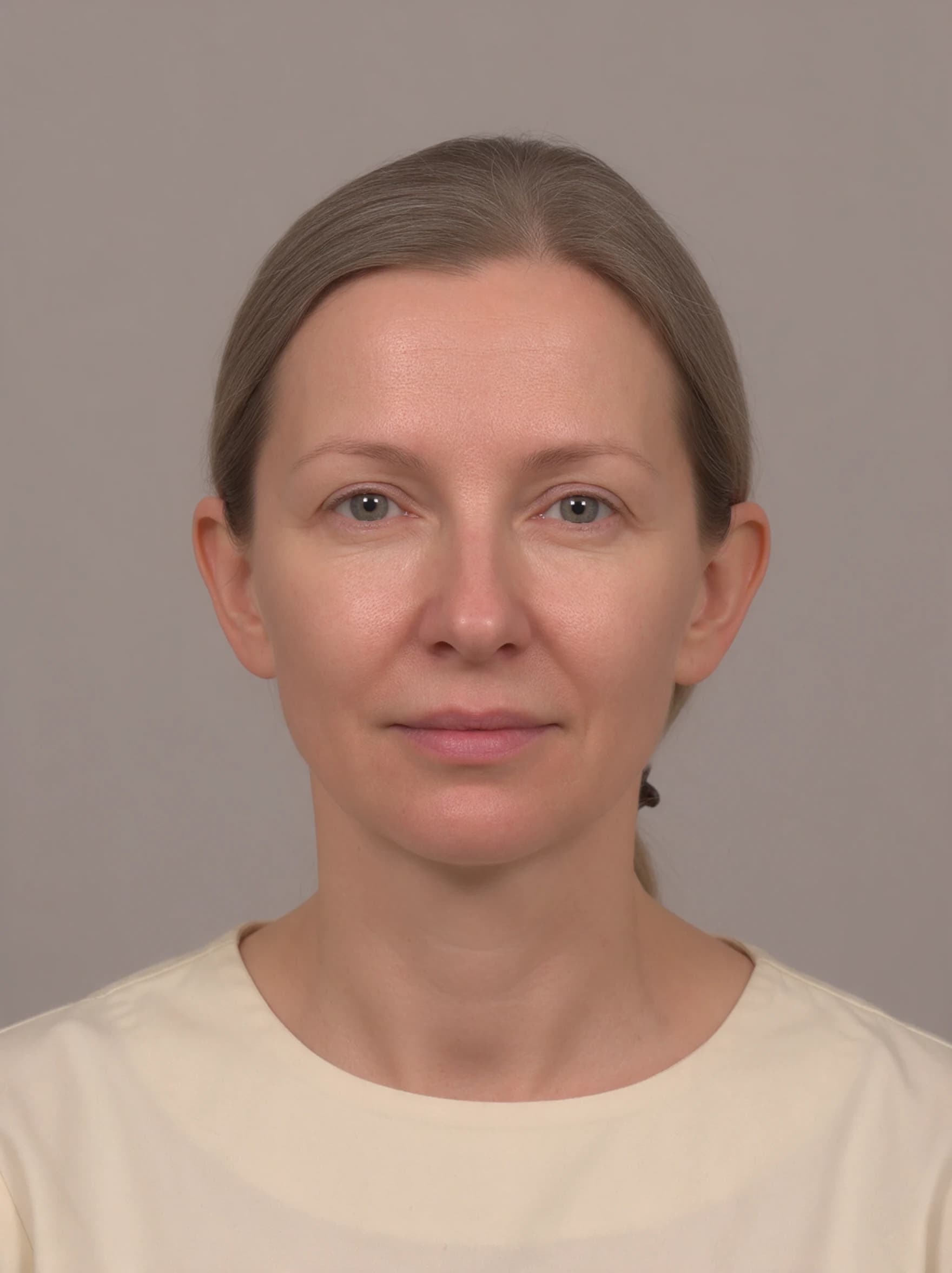 Thermage FLX — AI simulated consultation view before